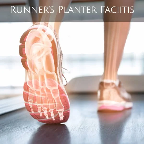 help runners plantar fasciitis